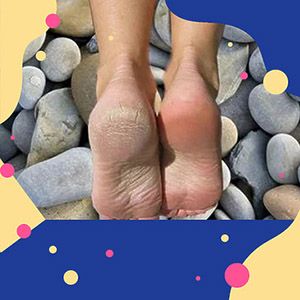 7 лучших способов добиться мягких пяток