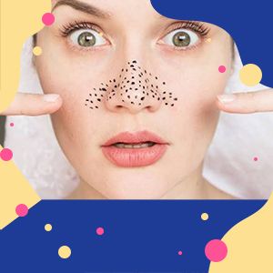 5 натуральных способов для избавления от черных точек дома